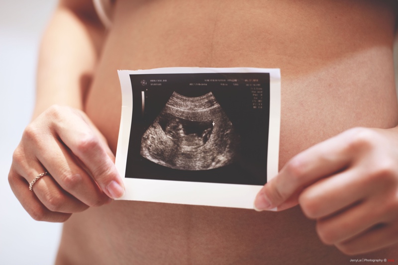 Trotz nfp schwanger Schwanger werden